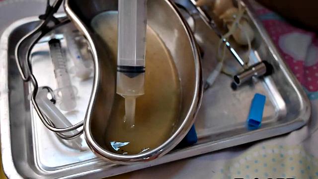 Asian 21yo barebacked by doctor in home visit