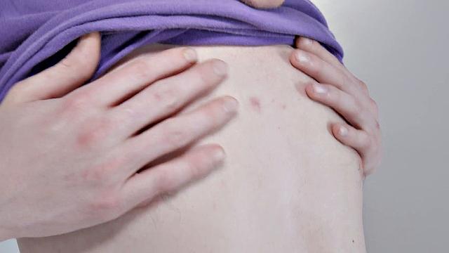 See Little Jimmy Michaels II