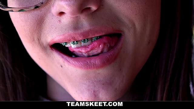 College Guys Love Braces