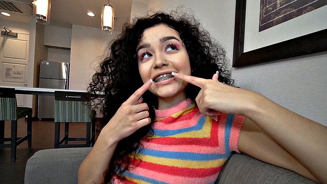 Before the Braces Go Off