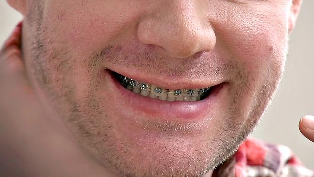 Orthodontic Ecstasies