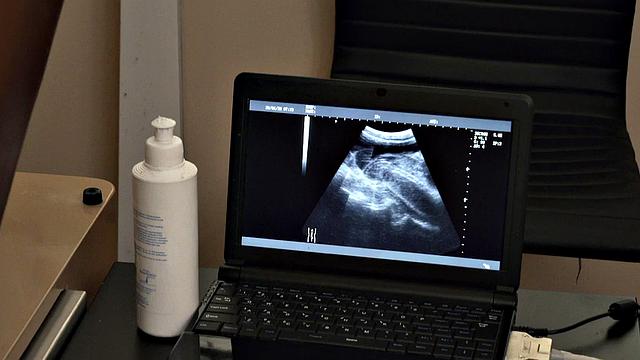 Short jock giving anal strips for doctor