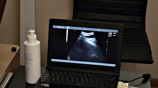 Short jock giving anal strips for doctor