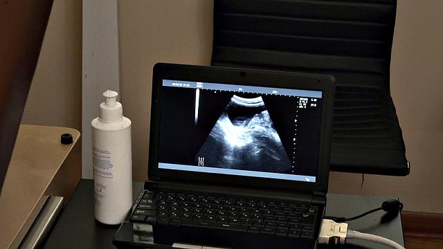 Short jock giving anal strips for doctor