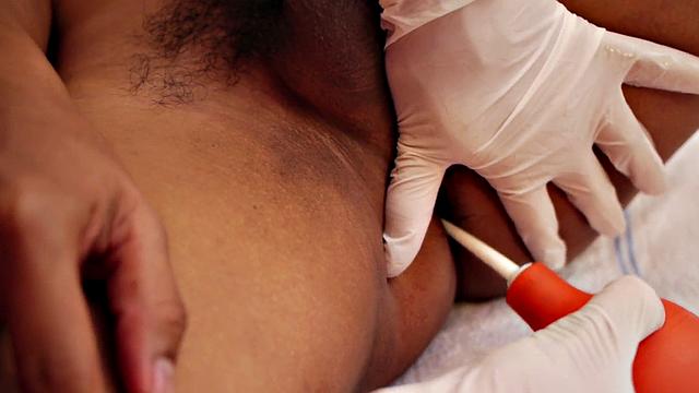 Nippon doctor barebacks 21yo patient after rimjob