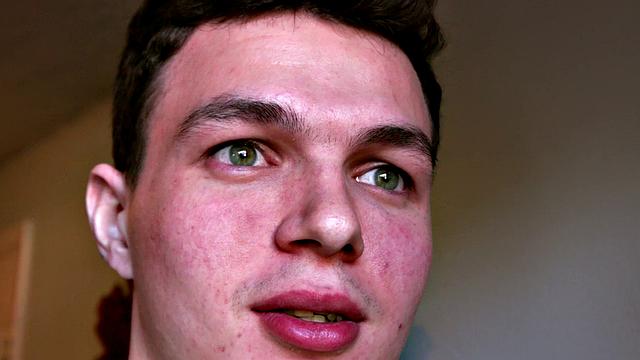 Remi Ferdinand: What Would You Do?