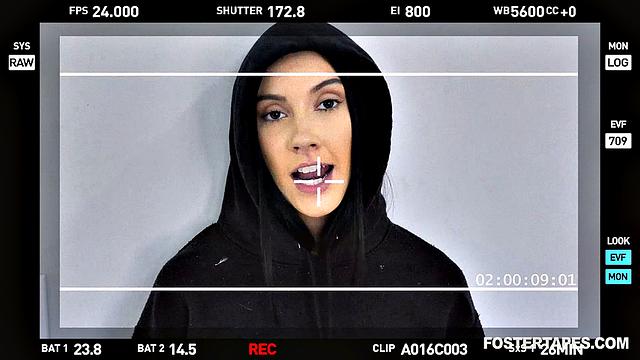 Foster Daughter Accepts Attention