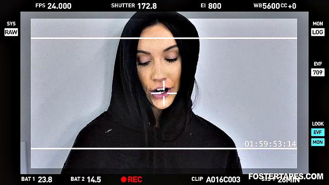 Foster Daughter Accepts Attention