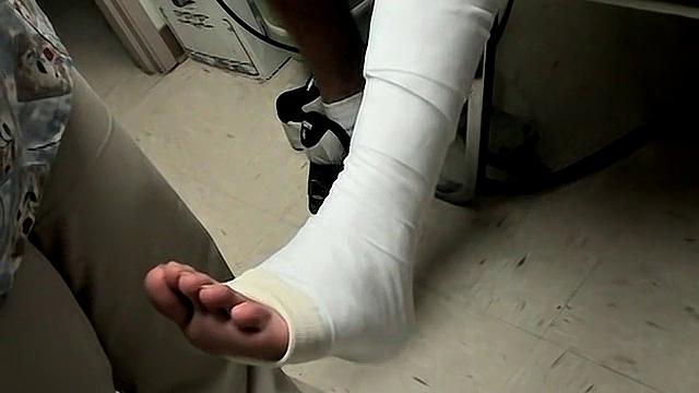 Foot Cast for Evan in Need - Featuring Evan Heinze and Ian Madrox