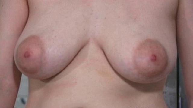 Extreme Tit Torment Nine