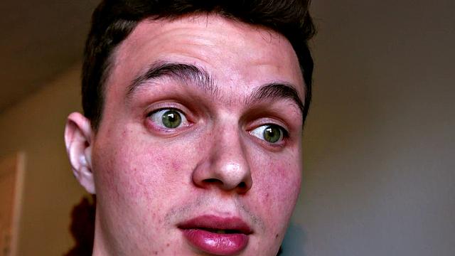 Remi Ferdinand: What Would You Do?